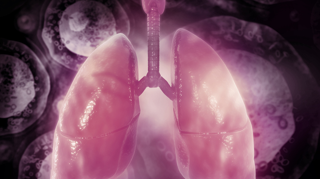 Rally Inhaled Nitric Oxide Gas Therapy in Mechanically Ventilated
